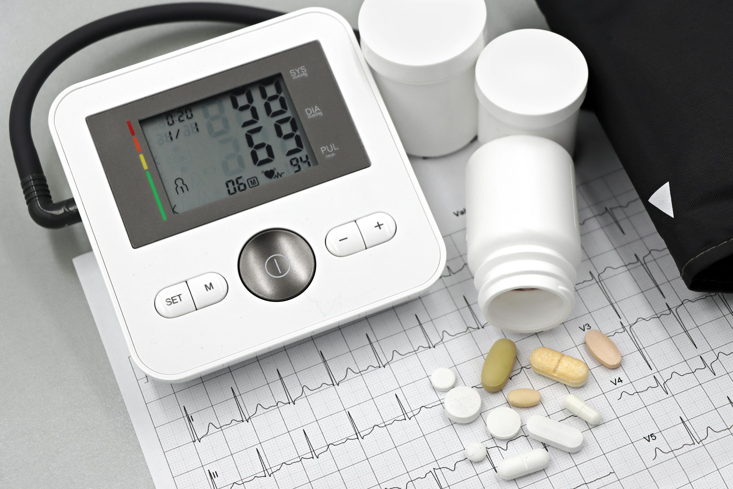 Arthrose verstehen – Ursachen, Symptome und effektive Behandlung